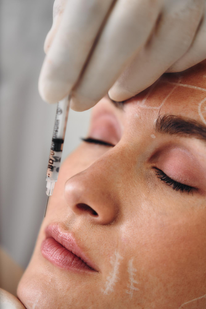 Tratamientos Skinbooster en Madrid
