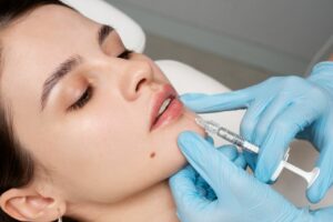 Tratamiento de ácido hialurónico para los labios