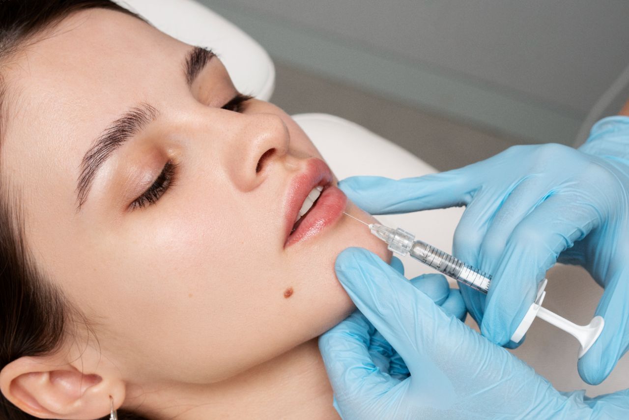 Tratamiento de ácido hialurónico para los labios