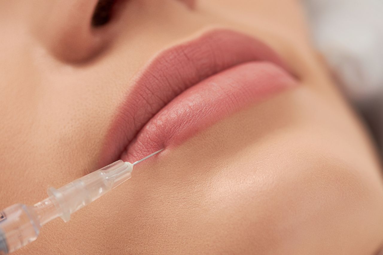 Tratamiento de ácido hialurónico para los labios