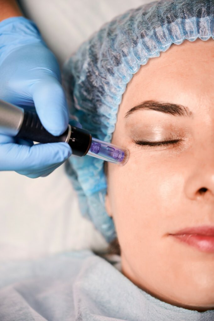 dermapen facial