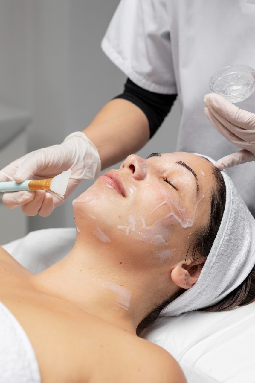 Peeling Químico